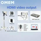 Digital Electronic Colposcope for Gyn Exam w/ HDMI Input Software