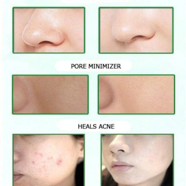 Mask Tea Green Clay Stick Purifying Deep Remover Blackhead Facial Control Mud - Image 3 of 4