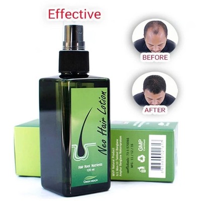 1x Neo Hair Lotion 120ml Growth Root Hair Loss Treatments beards sideburns