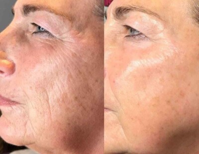 Peptide Cream Hyaluronic Acid ha Wrinkle Collagen Firm Vitamin C Anti Aging