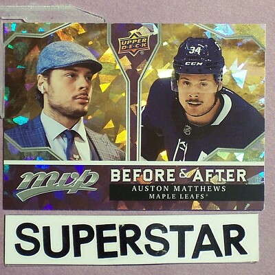 AUSTON MATTHEWS  2021-22  Upper Deck  MVP  Before After  GOLD #BA-1  Maple Leafs
