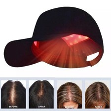650nm Red Led Light Therapy Hat Hair Loss Treatment Cap Hair Growth Regrowth2026