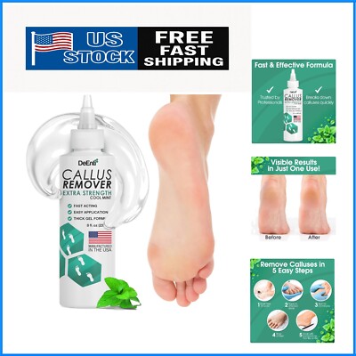 Professional 8oz Callus Remover Gel with Precision Application for Smooth Feet