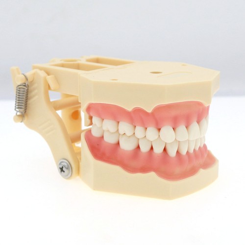 Dental Typodont Zahnmodell Implantat Pathologisch Perio Restauration Praxis Demo - Bild 264 von 312