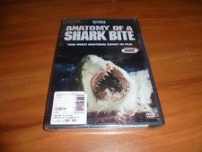 Anatomy of a Shark Bite (DVD, 2005) for sale online | eBay