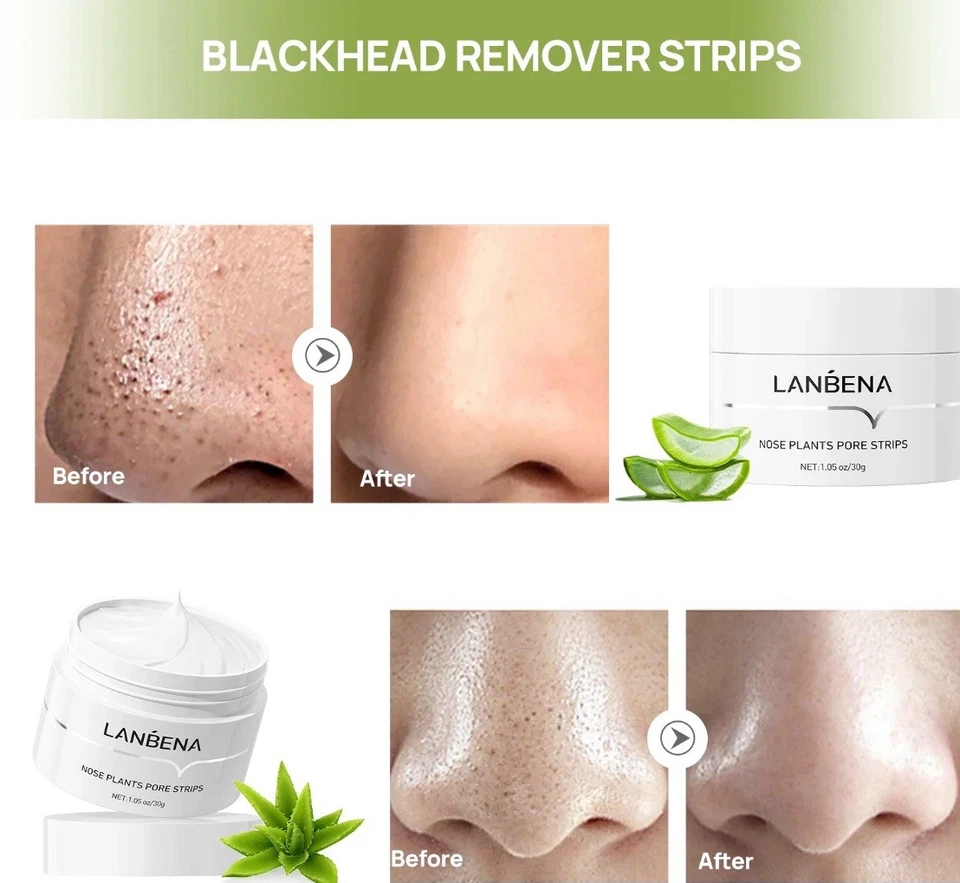 Máscara facial Lanbena Aloe Removedor de Espinillas Crema Nariz Poro Tiras, 30 g + 60 piezas Foto 4 de 4