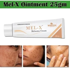 Dark Spot Corrector Cream Freckle Remover Blemish Reducer for Melasma Melanin US