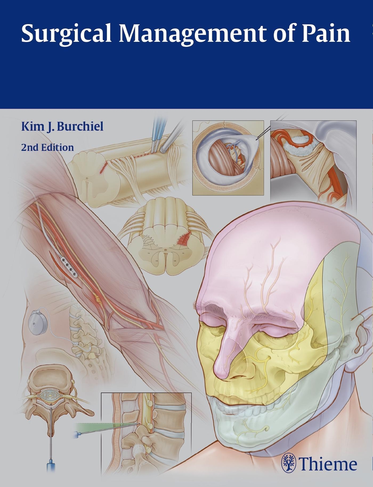 Thumbnail - Surgical Management Of Pain | Kim J Burchiel | Buch | 652 S. |