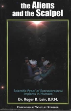 Aliens and the Scalpel ET Implants in Humans  UFO -GOOD paperback