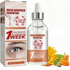 Milia Remover Serum for Face & Eyes ? Dual-Action Formula | UK FAST FREE SHIP