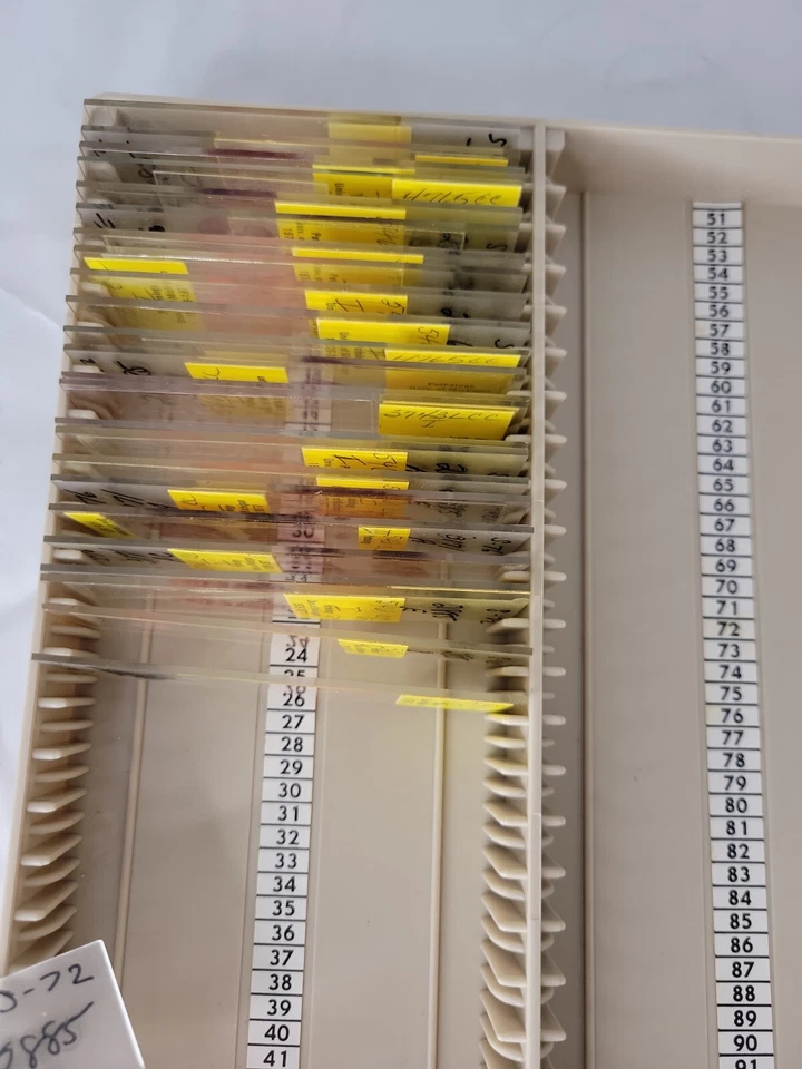 1976-77 Pathology Neoplasm University of Michigan Microscope Slides - Image 2 of 4