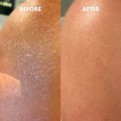 Kopari Ultra Restore Body Butter JUMBO Moisturizer for Dry Skin - Image 2 of 3