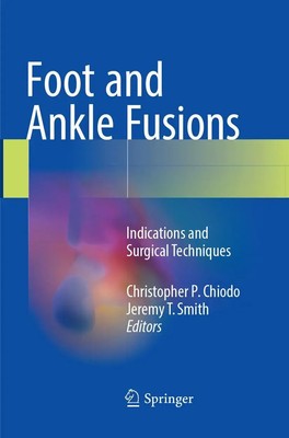 Christopher P. Chiodo (u. a.) | Foot and Ankle Fusions | Taschenbuch | Englisch