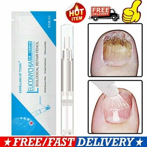 Nail Fungal Treatment Pen Anti Fungus Infection Biological Repairs Solution Care