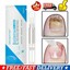 thumbnail 1 - Nail Fungal Treatment Pen Anti Fungus Infection Biological Repairs Solution Care
