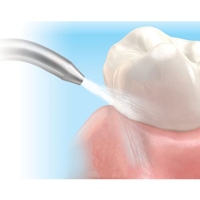 Dental Prophy Air Prophylaxis Powder Polish Teeth Remove Stain Cherry