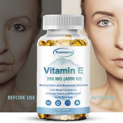 Vitamin E 4000IU 120pcs - Anti-aging, Antioxidant Support, Skin Health