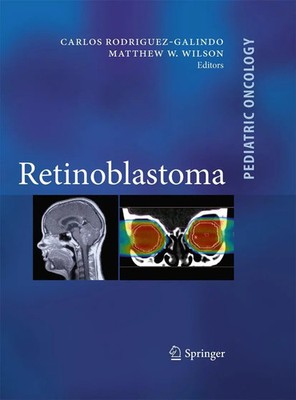 Carlos Rodriguez Galindo (u. a.) | Retinoblastoma | Taschenbuch | Englisch | xii