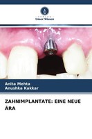 Anita Mehta (U. A.) | Zahnimplantate: Eine Neue ÄRA | Taschenbuch | Deutsch
