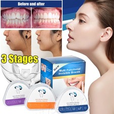 3 Stage Dental Orthodontic Teeth Corrector Braces Tooth Retainer Straighten Tool