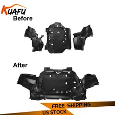 Front Under Cover Engine Splash Shield Fits 2015-2020 16 17 18 19 Honda FIT