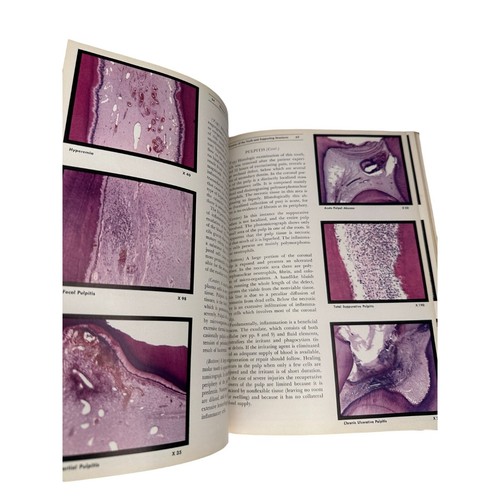 Vintage 1956 Color Atlas Of Oral Pathology Hardcover Book - Dentist - Foto 13 di 18