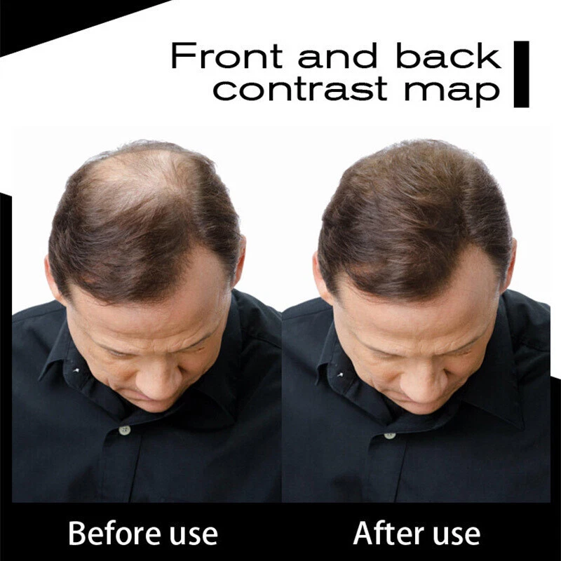 Sevich Hair Building Fibres Thickening Fibers Refill Hair Fibers Keratin Thicken - image 3 of 4