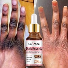 Dark Knuckle Whitening Serum - Even Tone, 50ml - Fast Results