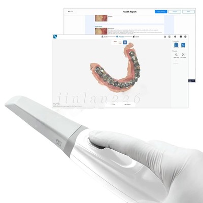 3D Digital Dental Intraoral Scanner System Scan CAD CAM Imaging Color Scanner
