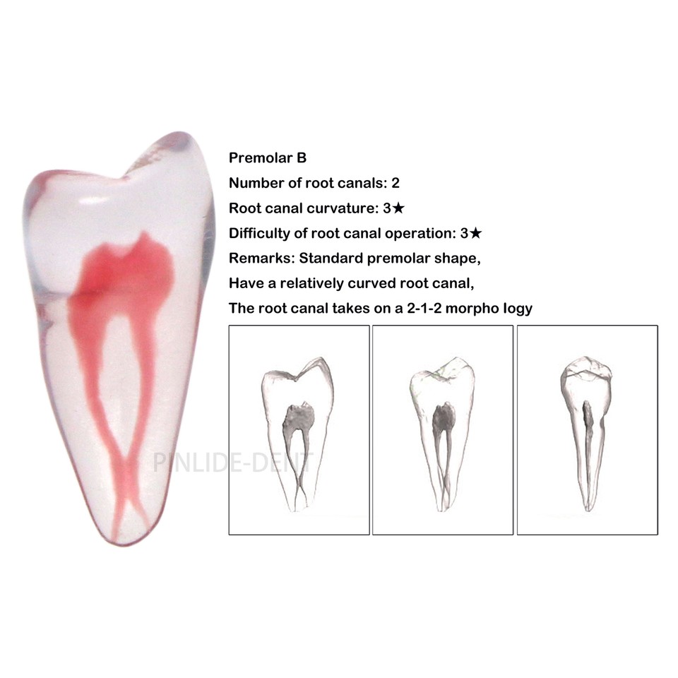 Rct Endo Block Dental Resin Root Canal Teeth Model Endo Practice Block RCT Pulp Cavity ...