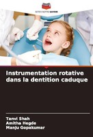 Instrumentation Rotative Dans La Dentition Caduque Tanvi Shah