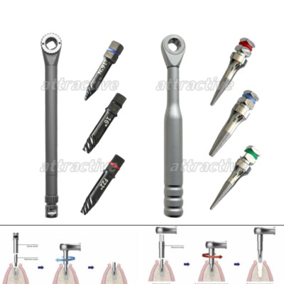 Broken Implant Pick Up Extractor Failed Fixture Remove Dental Driver Ratchet
