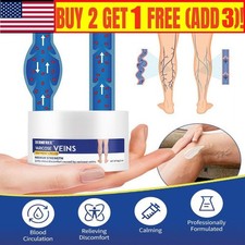 Varicose Veins Treatment for Legs, Spider  Varicose Veins Cream Natural Formula