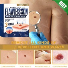 Skin Tag Remover Patches Quick Effective Mole and Wart Pad Removal Sticker US