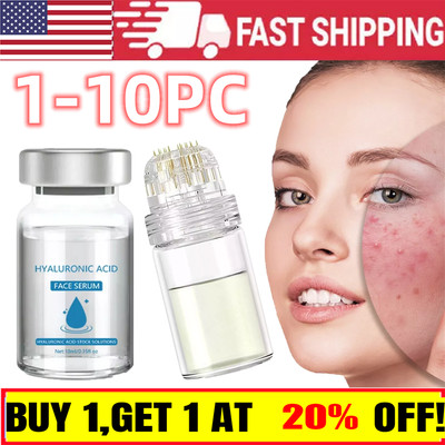 Glamory Micro Infusion System for Face Lips Keep hydrated and Refreshed.