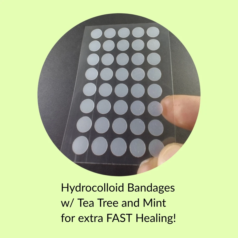 40 Acne Dots, Pimple Patches, Cystic Acne, Hydrocolloid Acne Spot Zit Stickers - Image 4 of 4