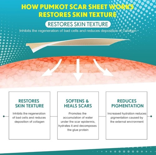 Silicone Scar Sheets, Silicone Scar Tape(1.6” x 120” Roll-3M), Scar Removal Away - Picture 8 of 8