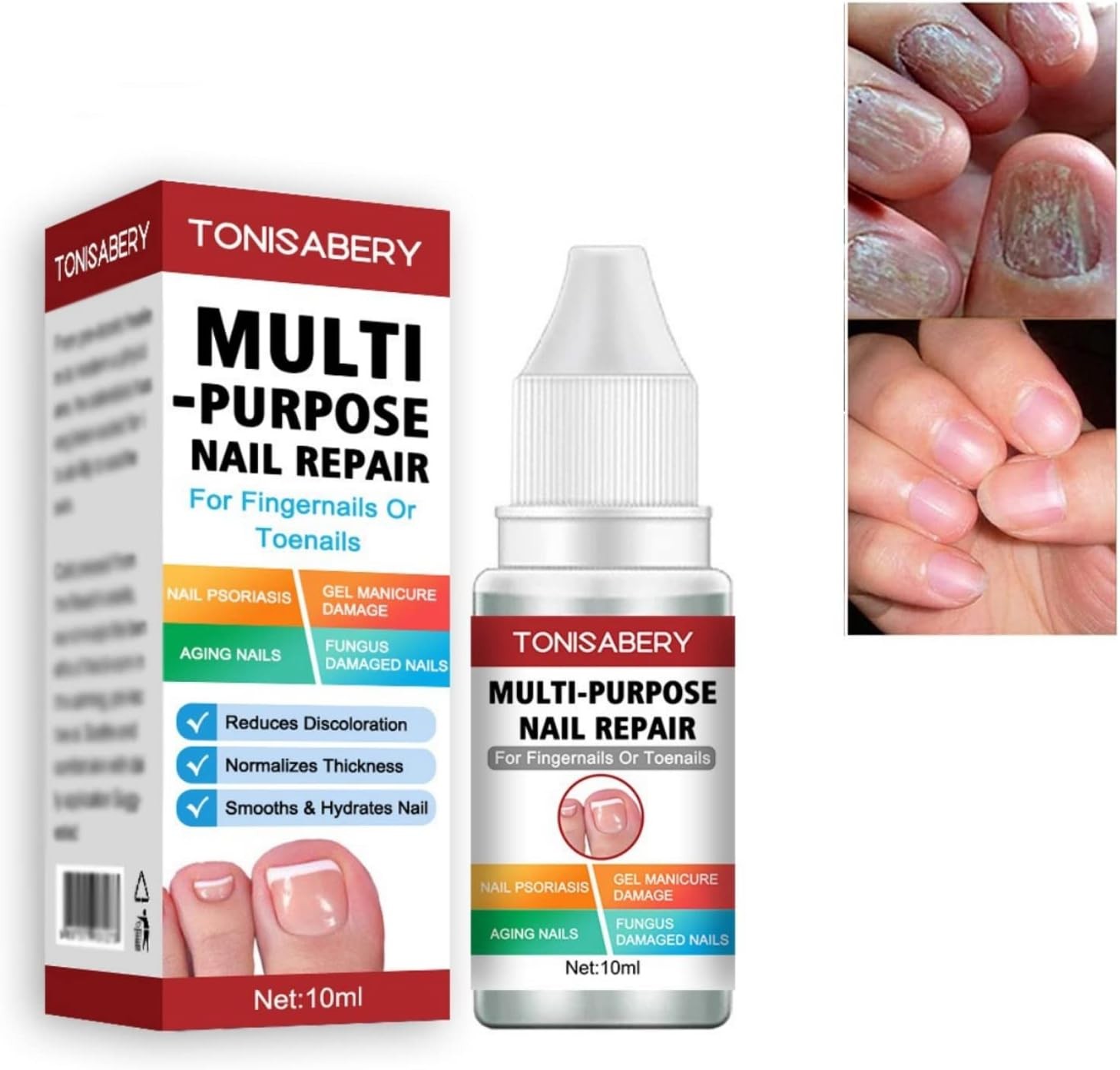 Fungal Nail Treatment,Nail Fungus Treatment Toenail,Toe Nail,Toenail Fungus Tre