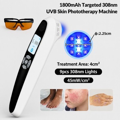 Home 308nm Excimer Lamp UVB Light Therapy Unit 9 Diodes 45mW/cm2 Rechargeable