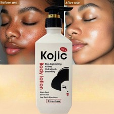 Kojic Skin Lightening Body Lotion Darkspots Brightenering, 500ml USA Stock     
