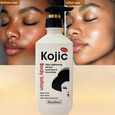 Kojic Skin Lightening Body Lotion Darkspots Brightenering, 500ml [USA Stock 🇺🇸