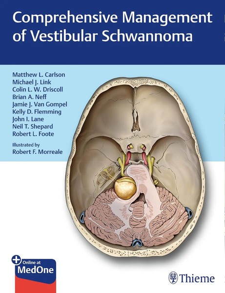 Comprehensive Management Of Vestibular Schwannoma | Matthew L Carlson (U. A.)-image