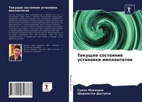 Suman MukheräE (U. A.) | Tekuschee Sostoqnie Ustanowki Implantatow | Taschenbuch
