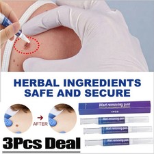 3Pcs 12 Hours Wart Remover Pen Skin Tag Mole Foot Corn Eliminate Warts Woman Man