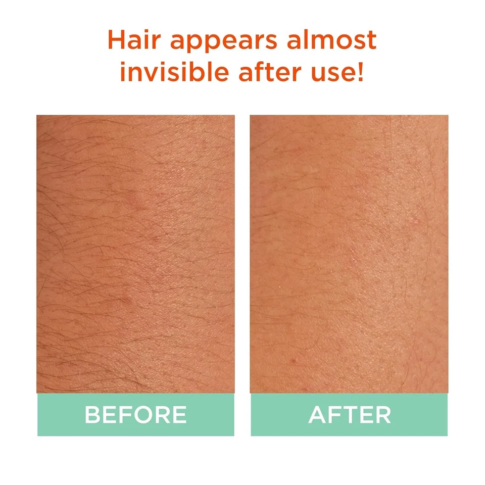 Sally Hansen Crema Blanqueadora Extra Fuerza, Kit Completo Pack de 2 (Paquete May Va Foto 3 de 4