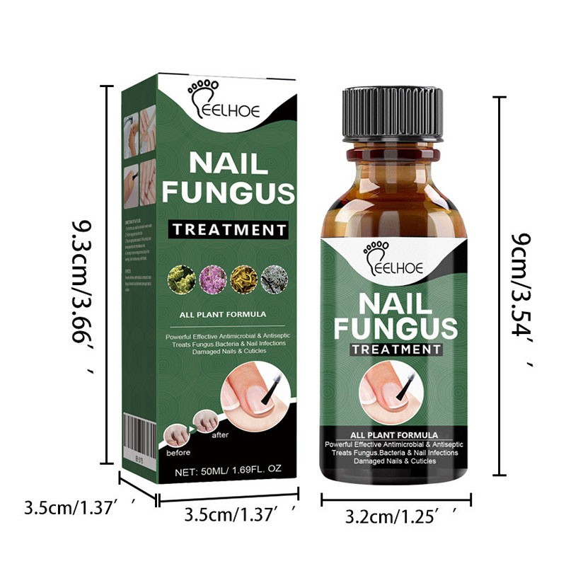 Nagelpilz Behandlung Antibakteriell 30/50ML für Zeh Fingernagel Pilz Infektion