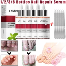 1-5X LANBENA Nail Repair Essence Serum Fungus Removal Gel Hand Foot Nails Care