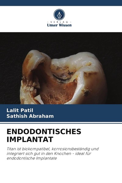 Endodontisches Implantat Lalit Patil-image