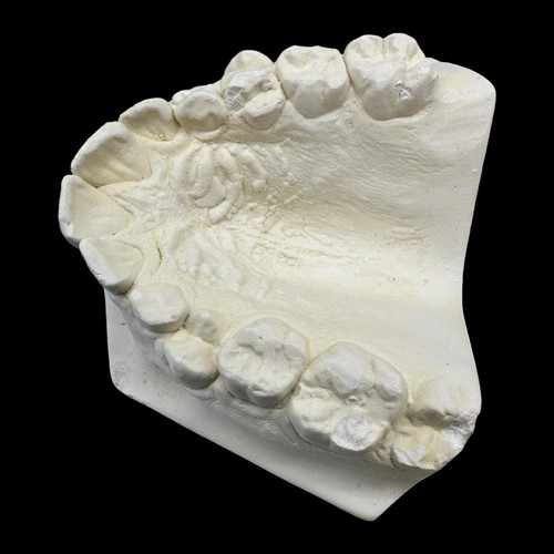 Vintage Plaster Dental Mold - Teeth Tooth Mold - Creepy Oddity - Dental Oddities - Foto 8 di 18