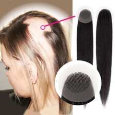 Full Lace Cover-up Tape Human Hair Patches Patch Hairpiece for Alopecia Areata